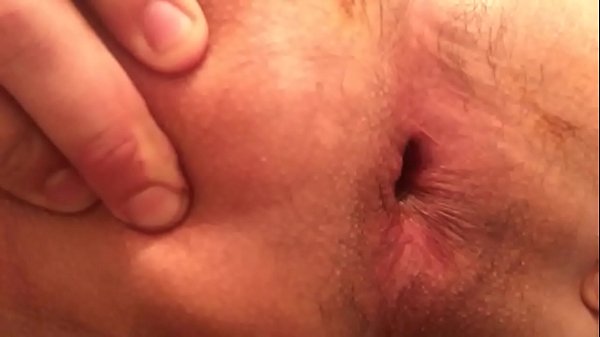 Gaping asshole up close